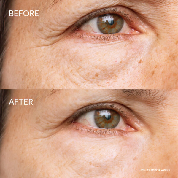 Skin reboot serum antyoksydacyjne do twarzy Iren Shizen efekty przed i po kilku tygodniach stosowania